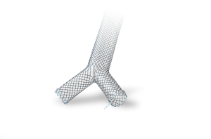 trachéale Stent